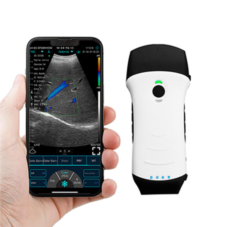 Konted Handheld Wifi Wireless Mobile Ultrasound Probe Scanner Device  Supplier